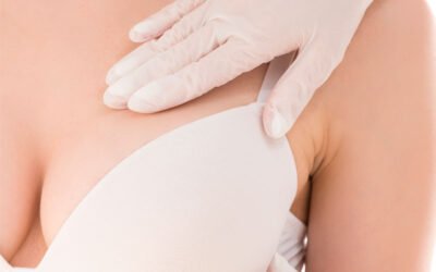 Reduccion mamaria – Beneficios reales: alivio del dolor, postura y calidad de vida