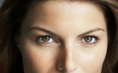 Quién es candidato a una blefaroplastia