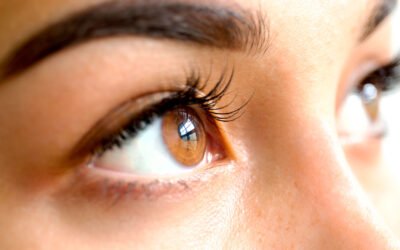 Blefaroplastia superior o inferior