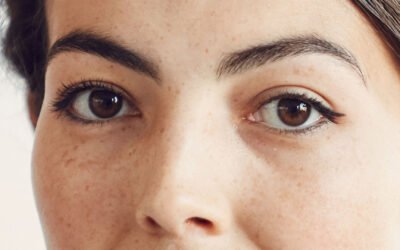 Blefaroplastia: Cuándo puedo volver al trabajo y al gimnasio